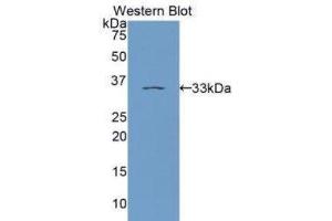 Western Blotting (WB) image for anti-Protein Kinase C, epsilon (PRKCE) (AA 403-672) antibody (ABIN1172891) (PKC epsilon anticorps  (AA 403-672))
