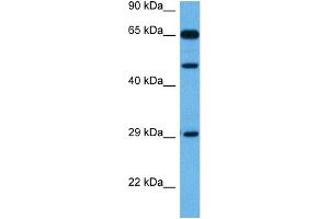 Host:  Rabbit  Target Name:  TP73  Sample Tissue:  Mouse Kidney  Antibody Dilution:  1ug/ml (Tumor Protein p73 anticorps  (Middle Region))
