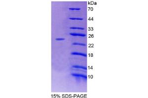 Image no. 1 for Adenylate Cyclase 7 (Adcy7) (AA 309-491) protein (His tag) (ABIN4988705)
