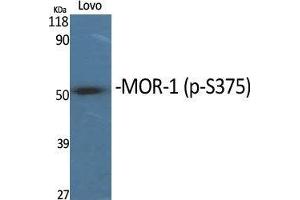 Western Blot (WB) analysis of specific cells using Phospho-MOR-1 (S375) Polyclonal Antibody. (Mu Opioid Receptor 1 anticorps  (pSer375))
