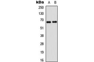 Western blot analysis of PAK1 expression in A431 (A), HEK293T (B) whole cell lysates. (PAK1 anticorps  (Center))