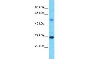 Host:  Rabbit  Target Name:  RNF217  Sample Type:  Liver Tumor lysates  Antibody Dilution:  1. (RNF217 anticorps  (N-Term))