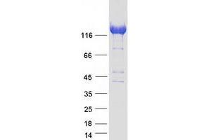 Validation with Western Blot