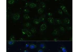 Immunofluorescence analysis of C6 cells using COPG2 Polyclonal Antibody at dilution of 1:100 (40x lens).