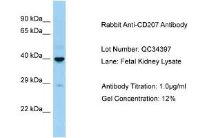 Host: Rabbit Target Name: CD207 Sample Type: Fetal Kidney Antibody Dilution: 1. (CD207 anticorps  (C-Term))