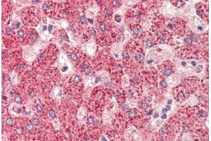 Human Liver: Formalin-Fixed, Paraffin-Embedded (FFPE) (ETFA anticorps  (AA 276-304))