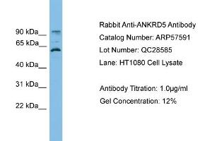 WB Suggested Anti-ANKRD5  Antibody Titration: 0. (ANKRD5 anticorps  (N-Term))