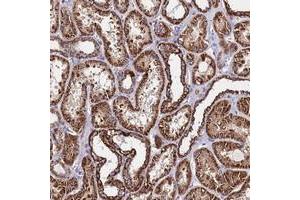Immunohistochemical staining of human kidney with OR8S1 polyclonal antibody  shows strong cytoplasmic positivity in cells in tubules at 1:50-1:200 dilution. (OR8S1 anticorps)