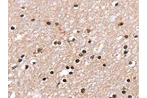 The image on the left is immunohistochemistry of paraffin-embedded Human brain tissue using ABIN7130904(RNF40 Antibody) at dilution 1/25, on the right is treated with fusion protein. (RNF40 anticorps)
