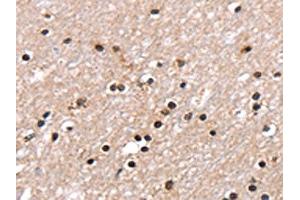 The image on the left is immunohistochemistry of paraffin-embedded Human brain tissue using ABIN7130904(RNF40 Antibody) at dilution 1/25, on the right is treated with fusion protein. (RNF4 anticorps)