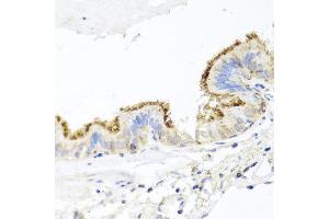 Immunohistochemistry of paraffin-embedded human trachea using CD44 antibody at dilution of 1:100 (x40 lens). (CD44 anticorps)