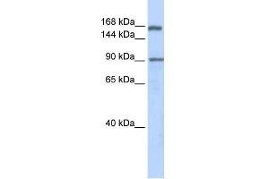 WB Suggested Anti-AFF2 Antibody Titration:  0. (AFF2 anticorps  (Middle Region))