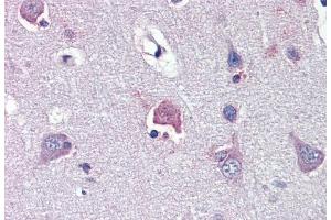 Immunohistochemistry with Human brain, cortex tissue at an antibody concentration of 5. (LDOC1 anticorps  (N-Term))