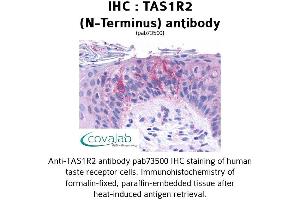 Image no. 1 for anti-Taste Receptor, Type 1, Member 2 (TAS1R2) (Extracellular Domain), (N-Term) antibody (ABIN1739916)