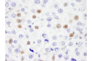 Immunohistochemistry (IHC) image for anti-Interferon Regulatory Factor 3 (IRF3) (AA 100-150) antibody (ABIN7449377) (IRF3 anticorps  (AA 100-150))