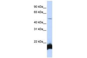 Image no. 1 for anti-One Cut Homeobox 1 (ONECUT1) (N-Term) antibody (ABIN6740547)