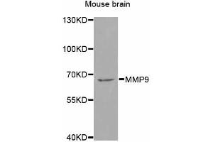 Western blot analysis of extracts of mouse brain, using MMP9 antibody (ABIN4904400) at 1:1000 dilution. (MMP 9 anticorps)