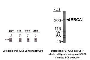 Image no. 1 for anti-Breast Cancer 1 (BRCA1) (AA 1314-1600), (AA 1314-1864) antibody (ABIN363234) (BRCA1 anticorps  (AA 1314-1600, AA 1314-1864))