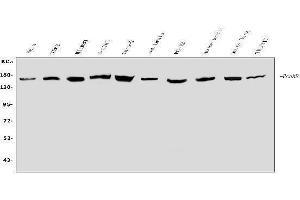 Western blot analysis of ROCK2 using anti-ROCK2 antibody (ABIN7602236).