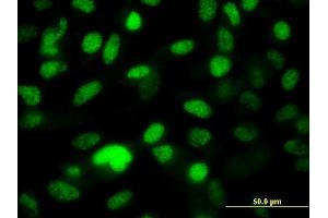 Immunofluorescence of monoclonal antibody to PPP1R8 on HeLa cell. (PPP1R8 anticorps  (AA 1-209))