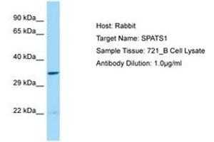 Image no. 1 for anti-Spermatogenesis Associated, Serine-Rich 1 (SPATS1) (AA 21-70) antibody (ABIN6750229) (SPATS1 anticorps  (AA 21-70))