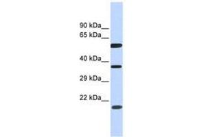 Image no. 1 for anti-5'-Nucleotidase Domain Containing 1 (NT5DC1) (AA 107-156) antibody (ABIN6743843) (NT5DC1 anticorps  (AA 107-156))