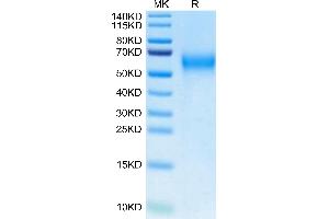 Biotinylated Cynomolgus IL-2 R gamma on Tris-Bis PAGE under reduced condition.