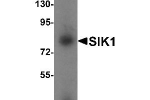 Western blot analysis of SIK1 in human small intestine tissue lysate with SIK1 antibody at 1 µg/mL. (SIK1 anticorps  (Middle Region))