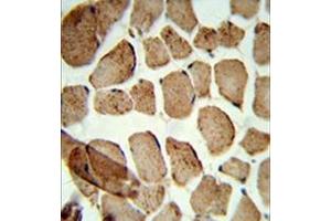 Formalin-fixed and paraffin-embedded human skeletal muscle reacted with Denatured ATG1 Antibody , which was peroxidase-conjugated to the secondary antibody, followed by DAB staining.
