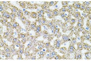 Immunohistochemistry of paraffin-embedded Rat liver using ALDH1A1 Polyclonal Antibody at dilution of 1:100 (40x lens).