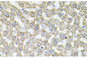 Immunohistochemistry of paraffin-embedded Rat liver using ALDH1A1 Polyclonal Antibody at dilution of 1:100 (40x lens). (ALDH1A1 anticorps)