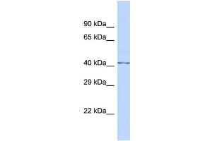 Host:  Rabbit  Target Name:  FKTN  Sample Type:  Fetal Brain lysates  Antibody Dilution:  1. (Fukutin anticorps  (N-Term))