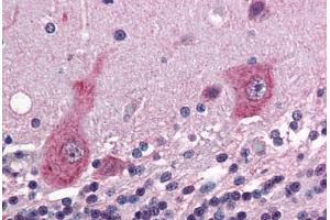Human Brain, Cerebellum (formalin-fixed, paraffin-embedded) stained with GRIK5 antibody ABIN343908 at 5 ug/ml followed by biotinylated goat anti-rabbit IgG secondary antibody ABIN481713, alkaline phosphatase-streptavidin and chromogen. (GRIK5 anticorps  (C-Term))