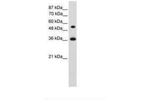 Image no. 1 for anti-Homeobox C11 (HOXC11) (AA 152-201) antibody (ABIN203334)