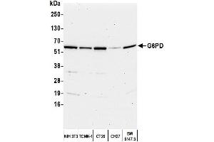 Western Blotting (WB) image for anti-Glucose-6-Phosphate Dehydrogenase (G6PD) (AA 50-100) antibody (ABIN7449226) (Glucose-6-Phosphate Dehydrogenase anticorps  (AA 50-100))