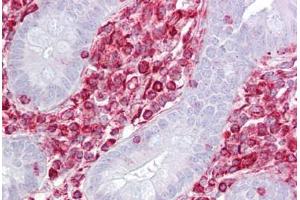 Anti-RACK1 antibody IHC staining of human small intestine. (GNB2L1 anticorps  (AA 71-120))