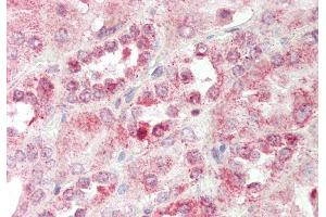 Rabbit Anti-SEC14L2 antibody  Formalin Fixed Paraffin Embedded Tissue: Human Kidney Primary antibody Concentration: 1:100 Secondary Antibody: Donkey anti-Rabbit-Cy3 Secondary Antibody Concentration: 1:200 Magnification: 20x Exposure Time: 0.