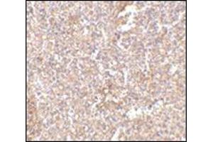 Immunohistochemistry of STEAP1 in human spleen tissue with this product at 2. (STEAP1 anticorps  (Center))