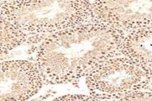 Immunohistochemistry analysis of paraffin-embedded rat testis using,MCM4 (ABIN7074631) at dilution of 1: 2400 (MCM4 anticorps)
