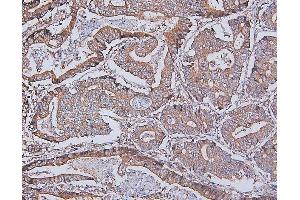 IHC analysis of DDR1 using anti-DDR1 antibody (ABIN7601407). (DDR1 anticorps  (AA 341-909))