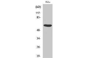 Western Blotting (WB) image for anti-PHD Finger Protein 1 (PHF1) (Internal Region) antibody (ABIN3176864) (PHF1 anticorps  (Internal Region))