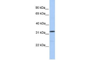 WB Suggested Anti-SPRY3 Antibody Titration:  0. (SPRY3 anticorps  (N-Term))
