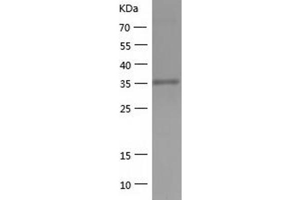 ELAVL2 Protein (AA 1-346) (His tag)