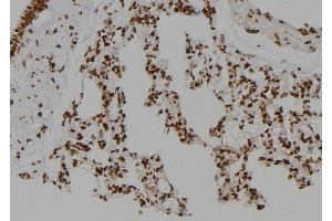 anti-Casein Kinase 2, alpha Prime Polypeptide (CSNK2A2) (N-Term) antibody