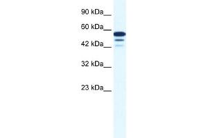 WB Suggested Anti-ZNF230 Antibody Titration:  0. (ZNF230 anticorps  (N-Term))