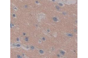 IHC-P analysis of Human Tissue, with DAB staining. (PPL anticorps  (AA 1439-1716))