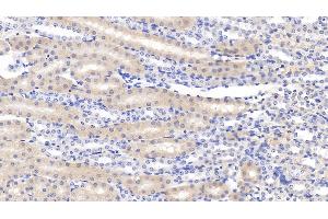 Detection of CLIC4 in Mouse Kidney Tissue using Polyclonal Antibody to Chloride Intracellular Channel Protein 4 (CLIC4)