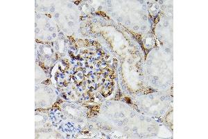 Immunohistochemistry of paraffin-embedded rat kidney using APOE Rabbit pAb (ABIN6133561, ABIN6137017, ABIN6137019 and ABIN6213793) at dilution of 1:50 (40x lens).