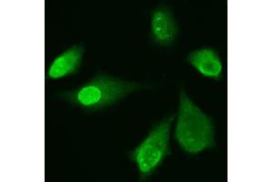 IF analysis of ADK using anti-ADK antibody (ABIN4886430). (ADK anticorps  (AA 165-351))