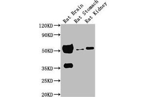 Western Blot Positive WB detected in: Rat brain tissue, Rat stomach tissue, Rat kidney tissue All lanes: TUBA1A antibody at 1:5000 Secondary Goat polyclonal to Mouse IgG at 1/10000 dilution Predicted band size: 52 kDa Observed band size: 52 kDa